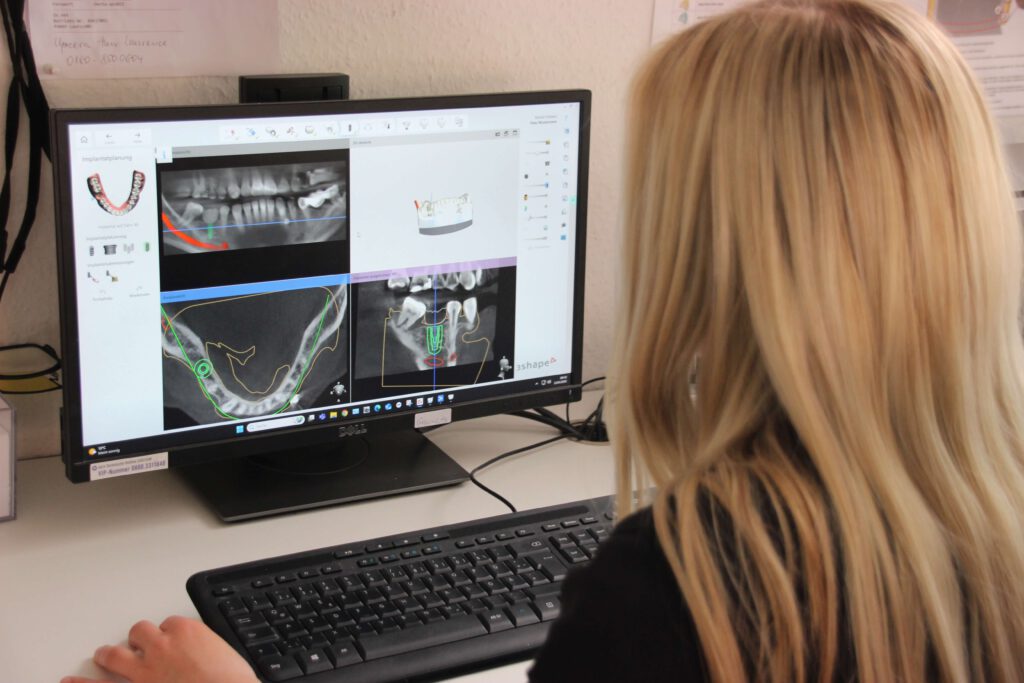 Implantatplanung